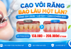 Cạo Vôi Răng Bao Lâu Một Lần? Giá 2026 Tại Cần Đước