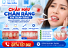 Chảy Máu Chân Răng Khi Đánh Răng – Nguyên Nhân, Cách Xử Lý Và Khi Nào Cần Đi Khám?