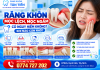 Răng Khôn Mọc Lệch, Mọc Ngầm Có Nguy Hiểm Không? Khi Nào Nhổ?
