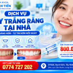 Tẩy Trắng Răng Tại Nhà Cần Đước – Quy Trình, Giá 2026