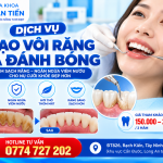 Cạo Vôi Răng Và Đánh Bóng Tại Cần Đước – Quy Trình, Lợi Ích Và Bảng Giá