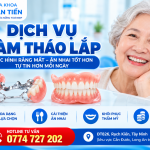 Hàm Tháo Lắp Tại Cần Đước – Phục Hình Răng Mất, Giá