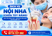 Chữa Tủy Răng Tại Cần Đước – Quy Trình & Bảng Giá 