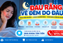  Đau Răng Về Đêm Do Đâu? Cách Giảm Đau Và Khi Nào Cần Khám