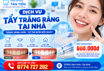 Tẩy Trắng Răng Tại Nhà Cần Đước – Quy Trình, Giá 2026