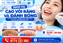 Cạo Vôi Răng Và Đánh Bóng Tại Cần Đước – Quy Trình, Lợi Ích Và Bảng Giá
