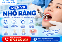  Dịch Vụ Nhổ Răng Tại Cần Đước – Bảng Giá & Quy Trình