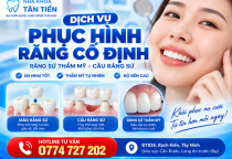  Phục Hình Răng Cố Định Tại Cần Đước – Giá Răng Sứ