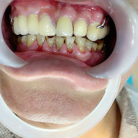 Huỳnh Văn Phụng 