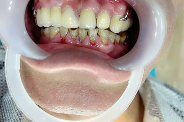 Huỳnh Văn Phụng 