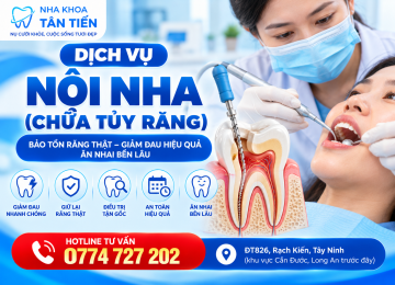 Chữa Tủy Răng Tại Cần Đước – Quy Trình & Bảng Giá 
