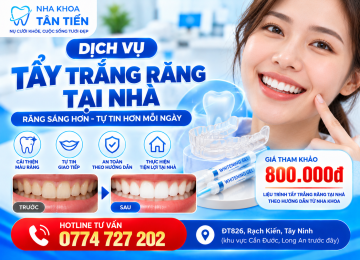 Tẩy Trắng Răng Tại Nhà Cần Đước – Quy Trình, Giá 2026