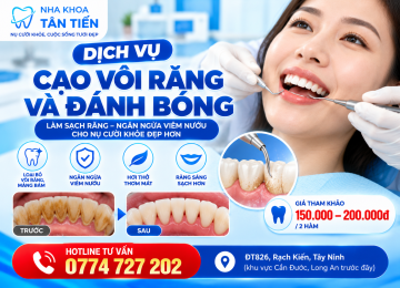 Cạo Vôi Răng Và Đánh Bóng Tại Cần Đước – Quy Trình, Lợi Ích Và Bảng Giá