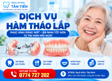 Hàm Tháo Lắp Tại Cần Đước – Phục Hình Răng Mất, Giá