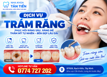 Trám Răng Tại Cần Đước – Trám Răng Sâu, Răng Mẻ, Bảng Giá