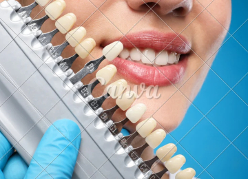 Dịch Vụ Hàm Tháo Lắp 