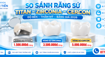 So Sánh Răng Sứ Titan, Zirconia, Cercon – Giá 2026