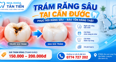 Trám Răng Sâu Tại Cần Đước – Giá Trám Răng 2026