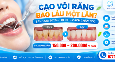 Cạo Vôi Răng Bao Lâu Một Lần? Giá 2026 Tại Cần Đước