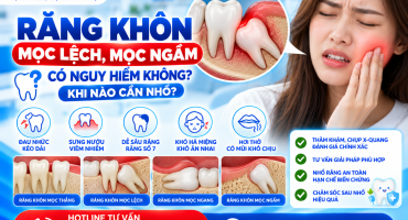 Răng Khôn Mọc Lệch, Mọc Ngầm Có Nguy Hiểm Không? Khi Nào Nhổ?