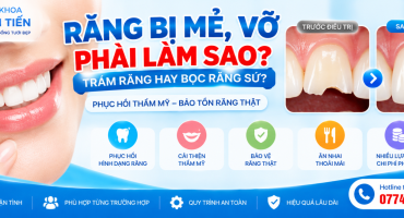 Răng Bị Mẻ, Vỡ Phải Làm Sao? Giá Trám Và Bọc Sứ 2026
