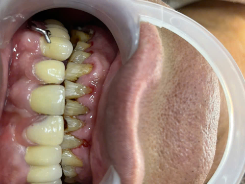 Huỳnh Văn Phụng 