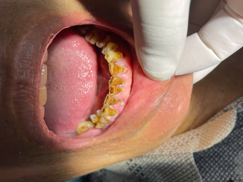 Huỳnh Văn Phụng 