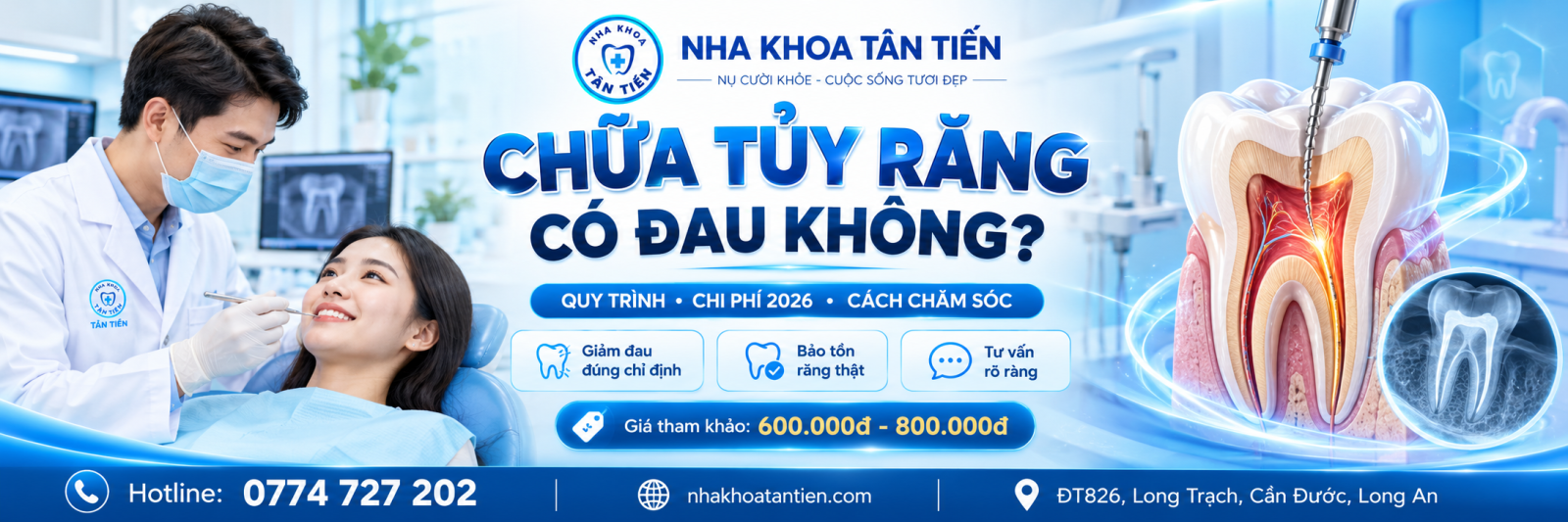 Chữa Tủy Răng Có Đau Không? Bảng Giá 2026 Tại Cần Đước