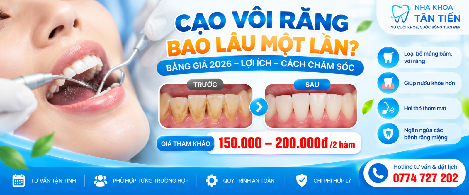 Cạo Vôi Răng Bao Lâu Một Lần? Giá 2026 Tại Cần Đước