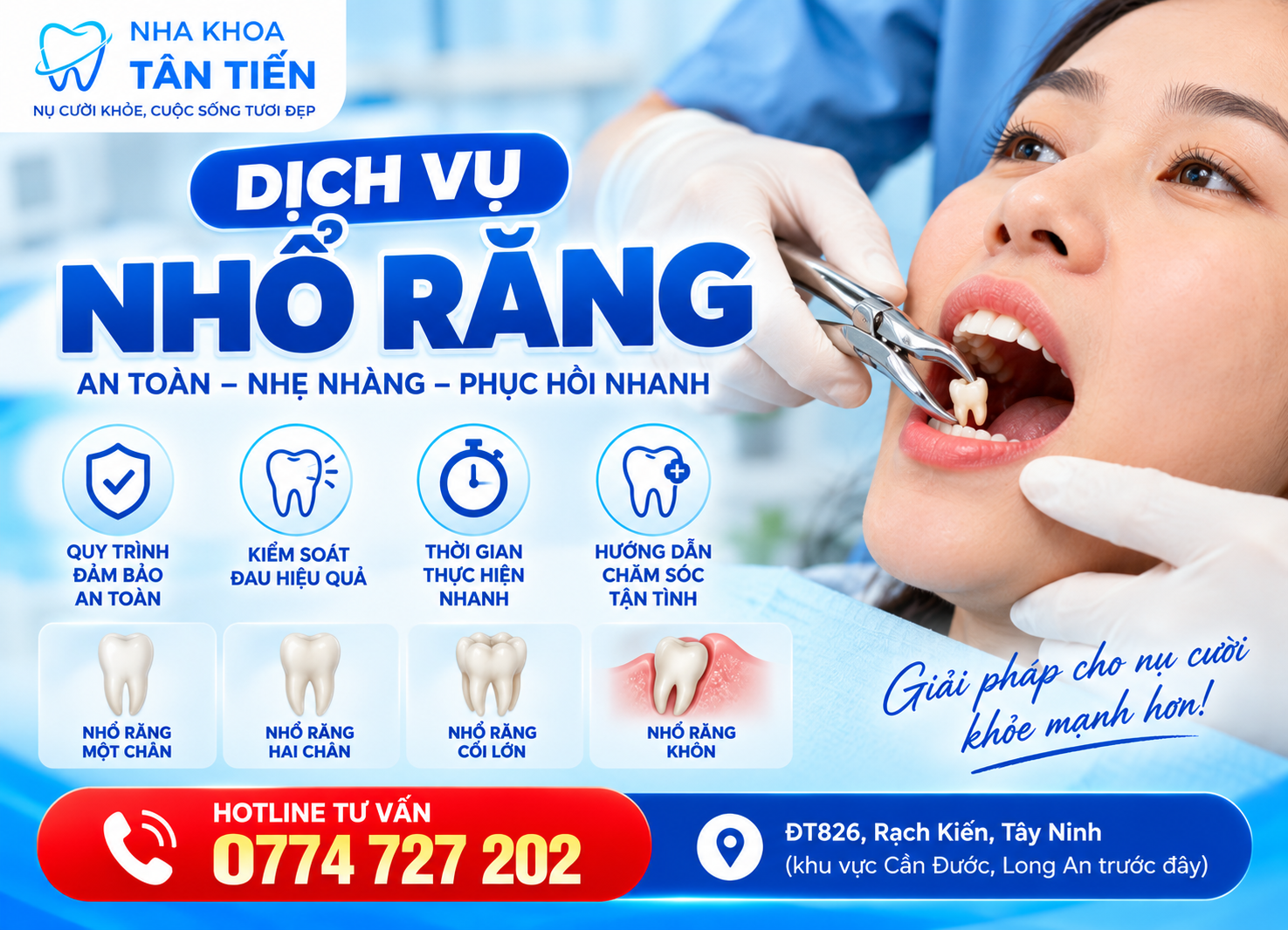 Dịch Vụ Nhổ Răng Tại Cần Đước – Bảng Giá & Quy Trình