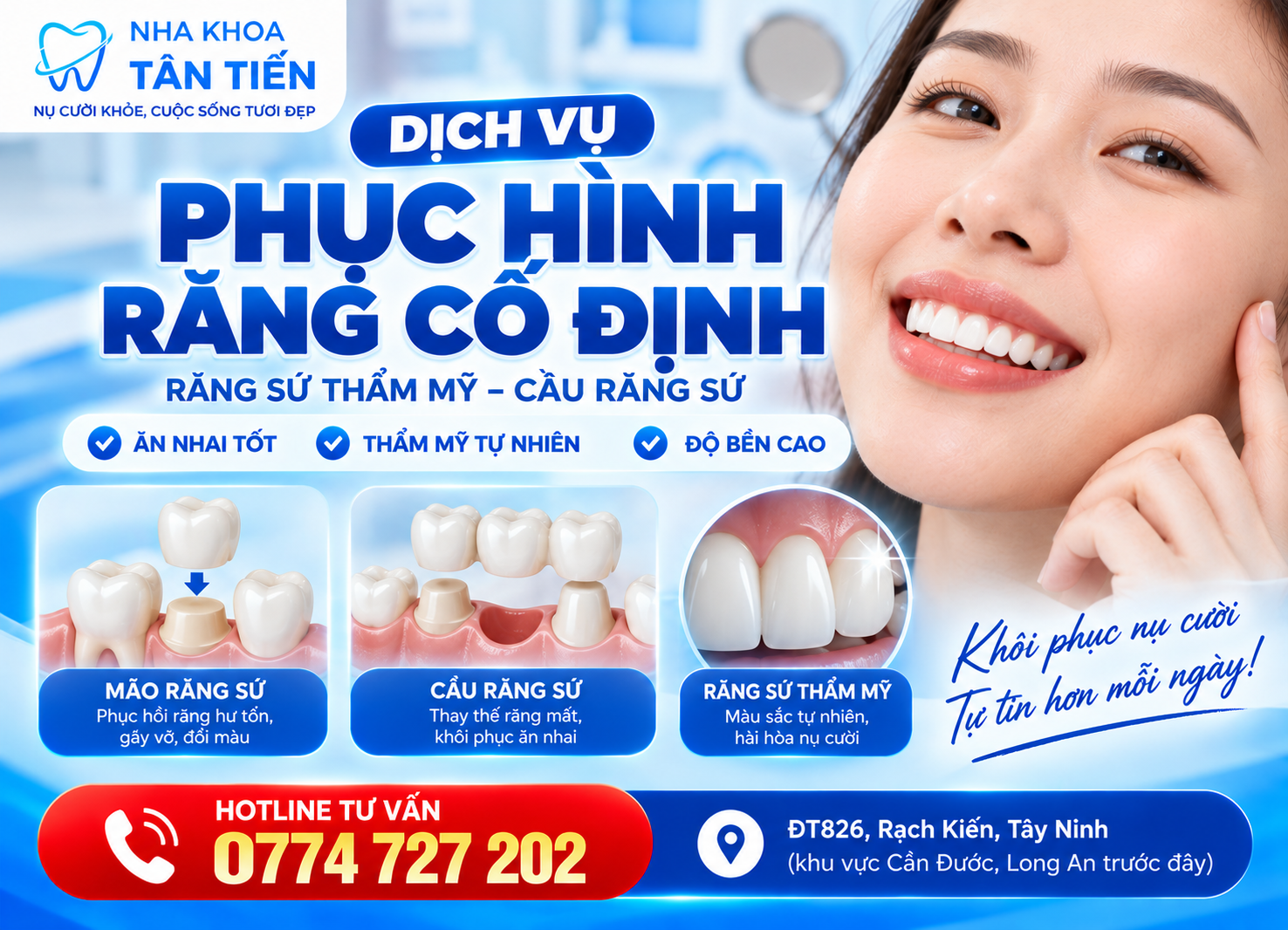 Phục Hình Răng Cố Định Tại Cần Đước – Giá Răng Sứ